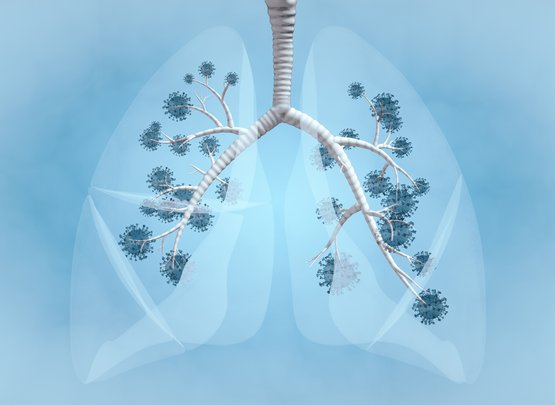Neue Moleküle könnten Asthma & COVID-bezogene Lungenerkrankungen bekämpfen 